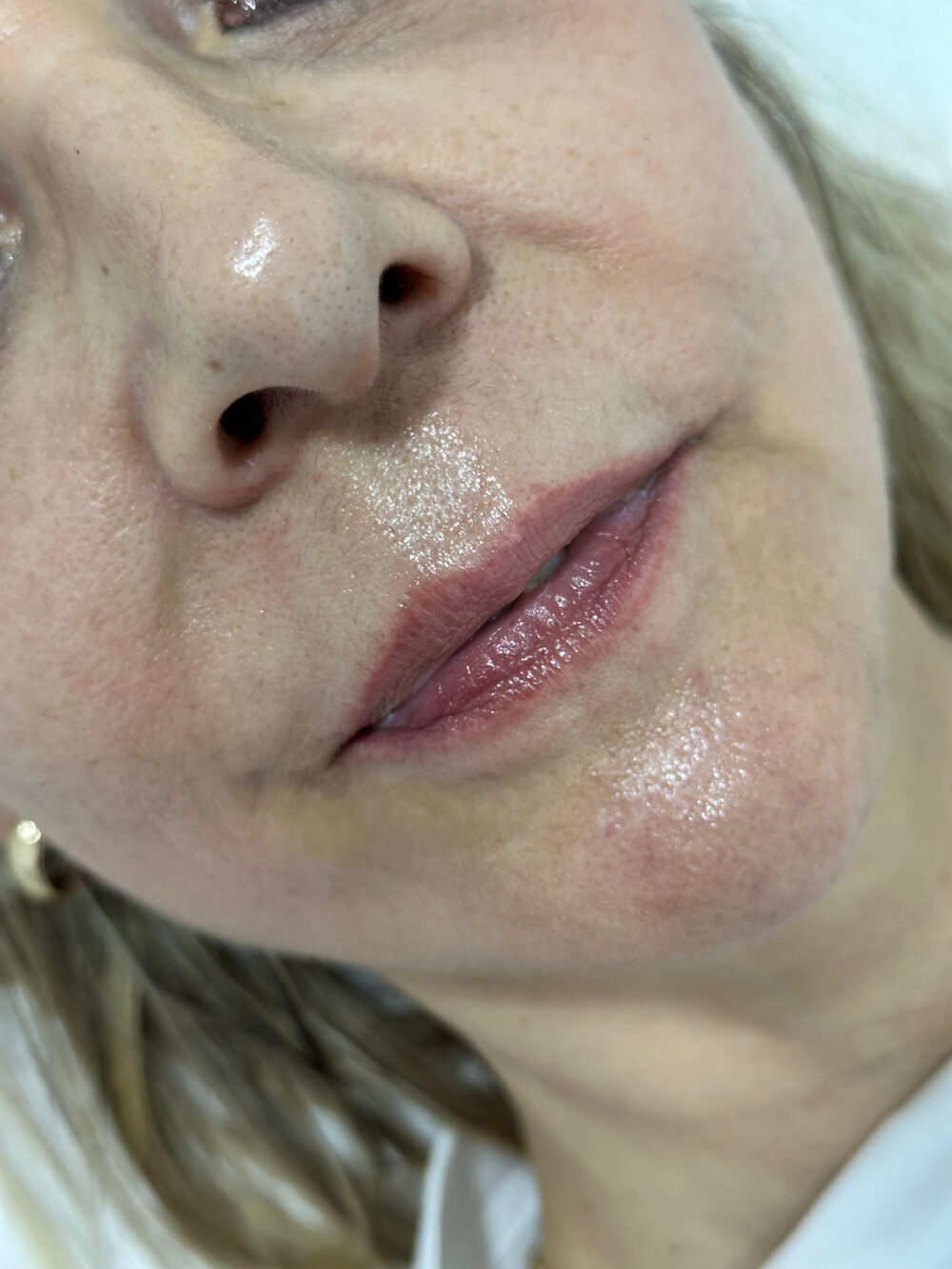 Hidratación y volumen natural de labios · Antes