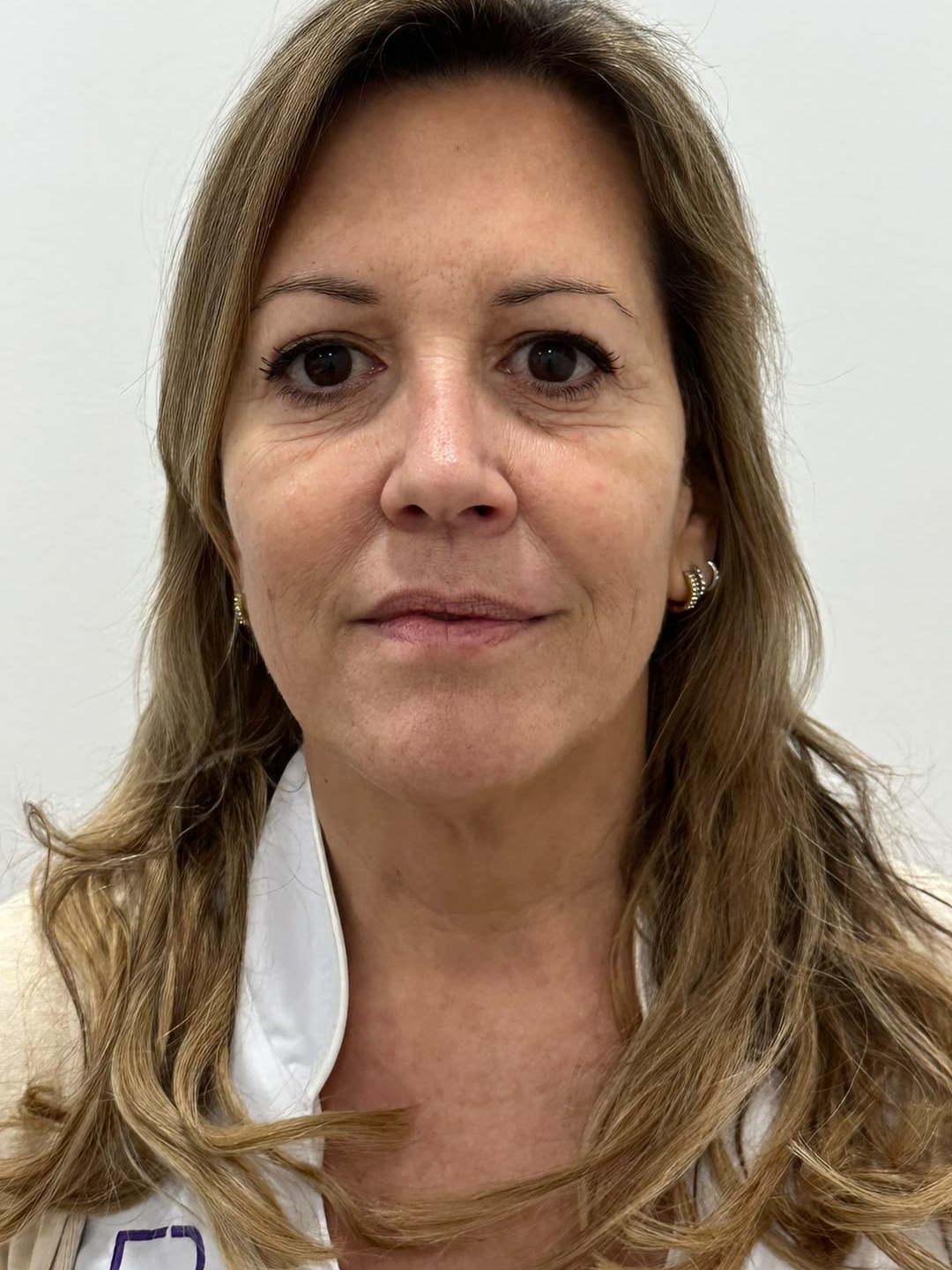 Bioestimulación con enzimas recombinantes · Antes