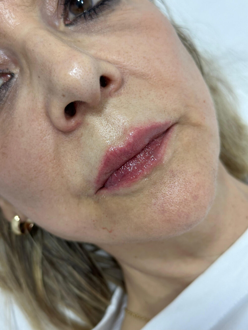 Hidratación y volumen natural de labios · Después